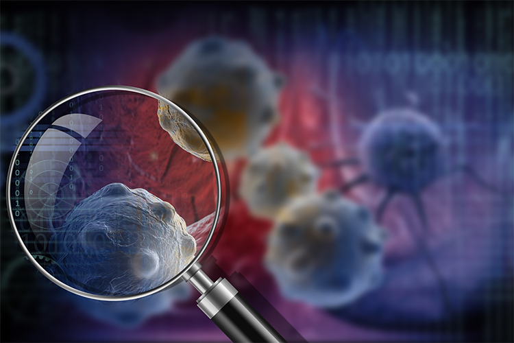 Anal Kanserin En Yaygın Nedeni: HPV Enfeksiyonu